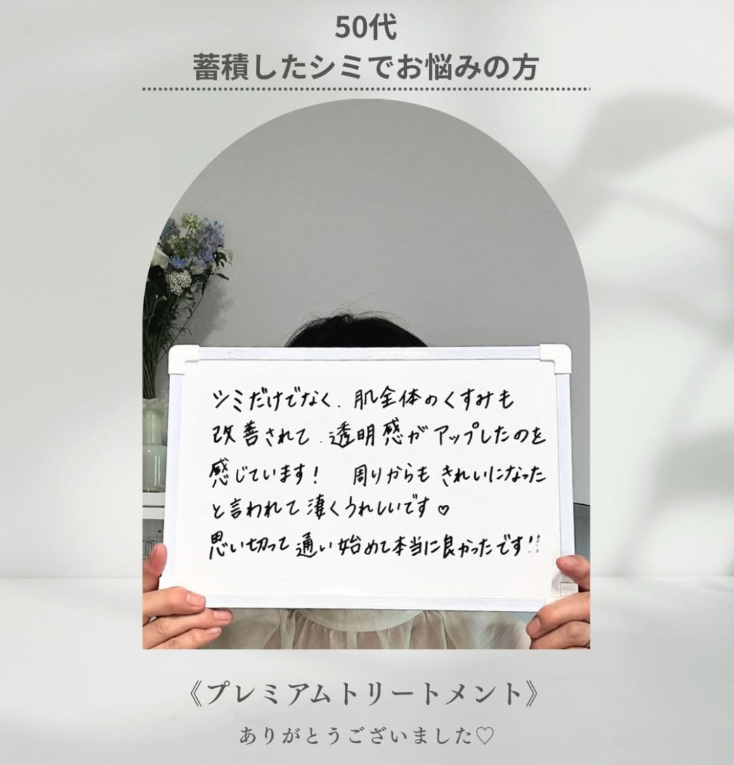 お客様の声 50代 蓄積したシミ